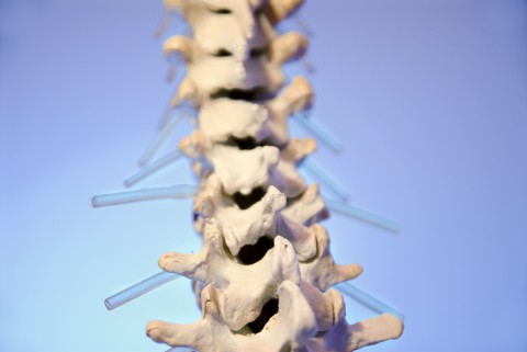 Gelenkknorpel Arthrose Therapie